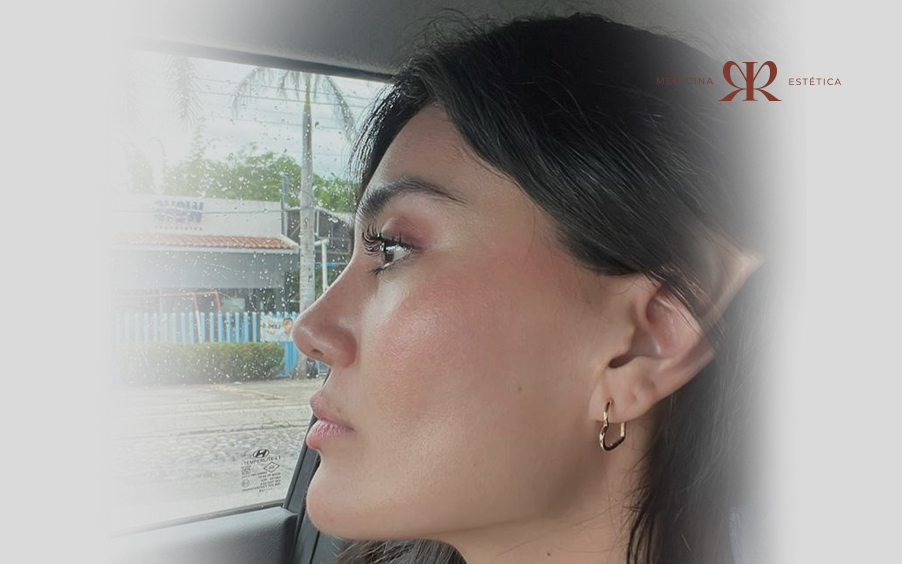 Antes del tratamiento facial